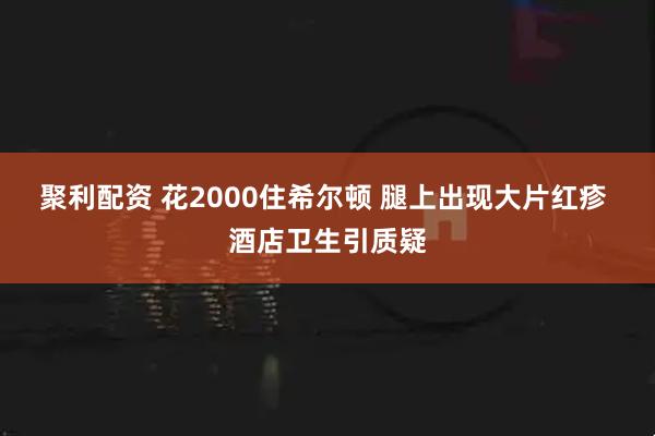 聚利配资 花2000住希尔顿 腿上出现大片红疹 酒店卫生引质疑